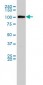 MVP Antibody (monoclonal) (M01)